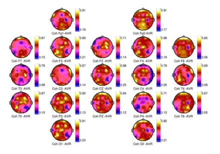 Mapeo de Potencia Espectral y Análisis Estadístico Z Score
